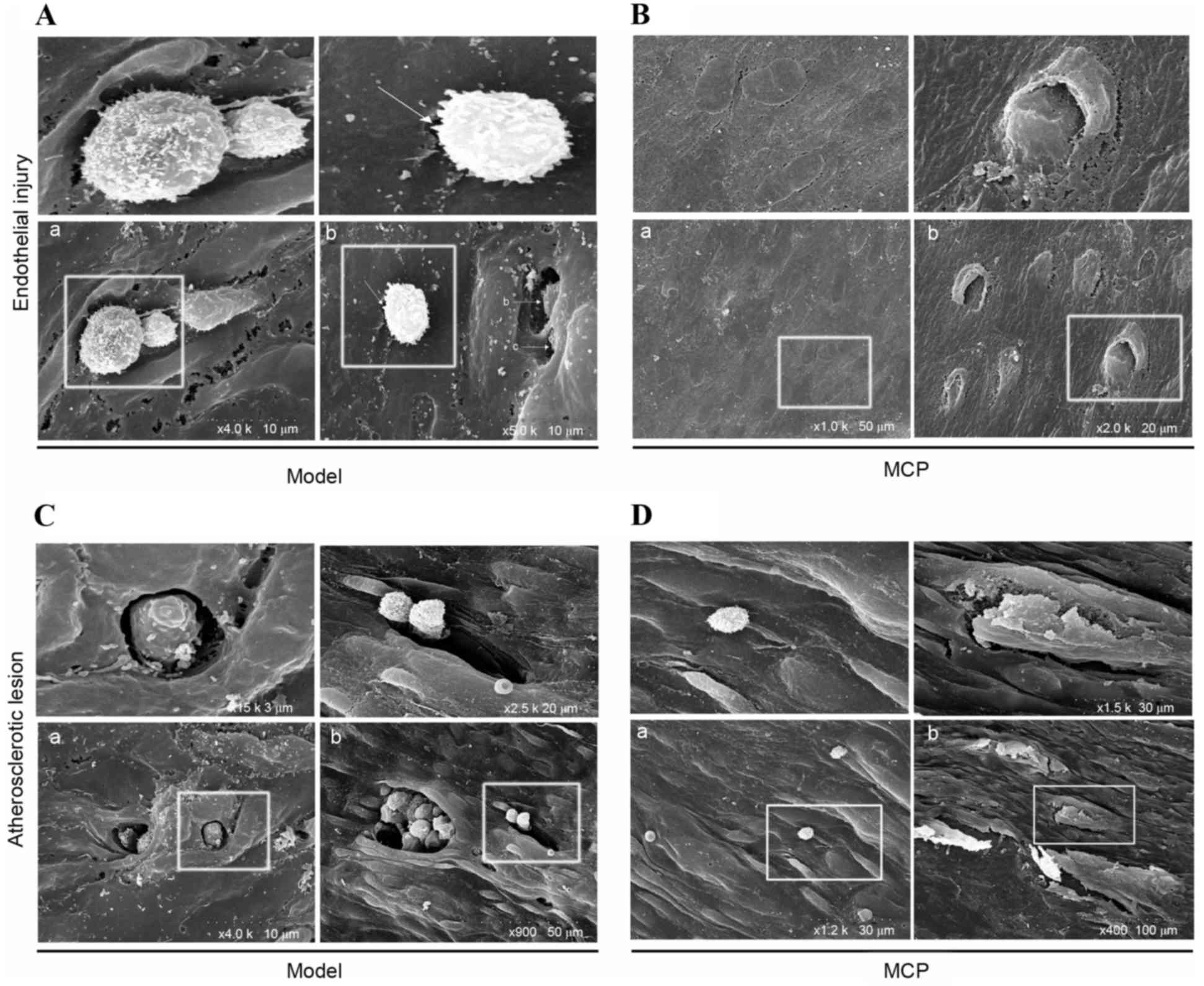 MCP IN atherosclerosis